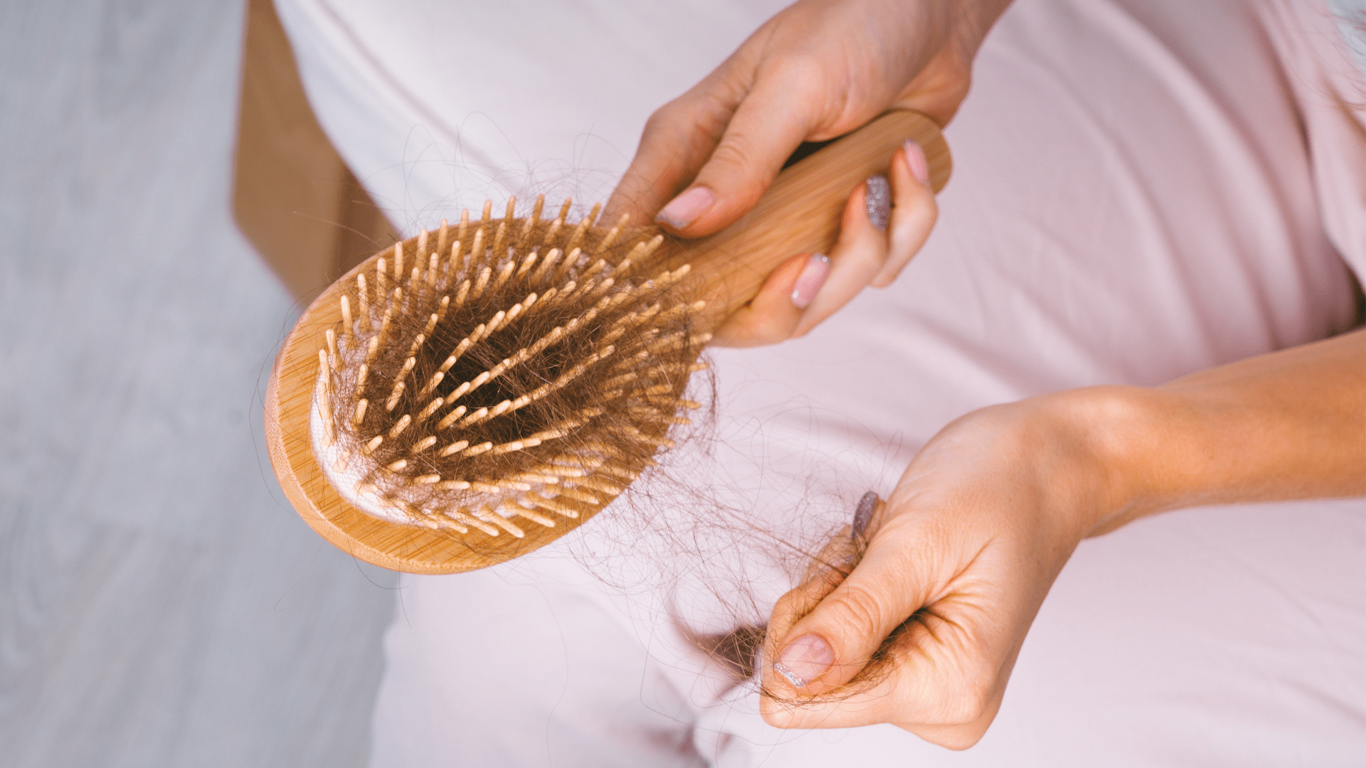 What Causes Hair Loss? Science, Solutions, and Support