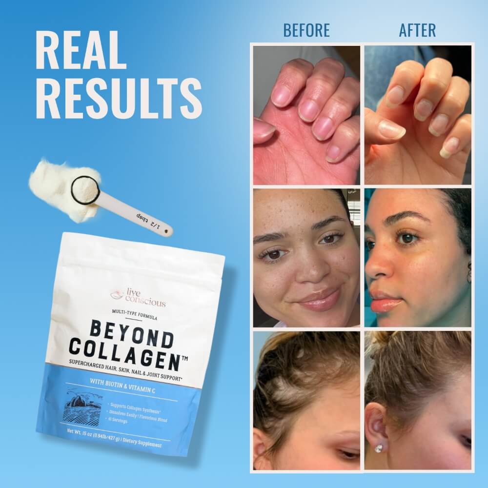 Beyond Collagen®