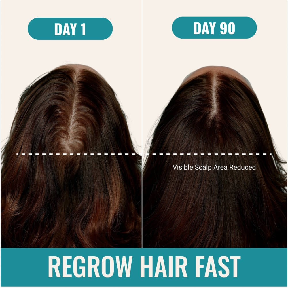 Clinical Hair Growth+
