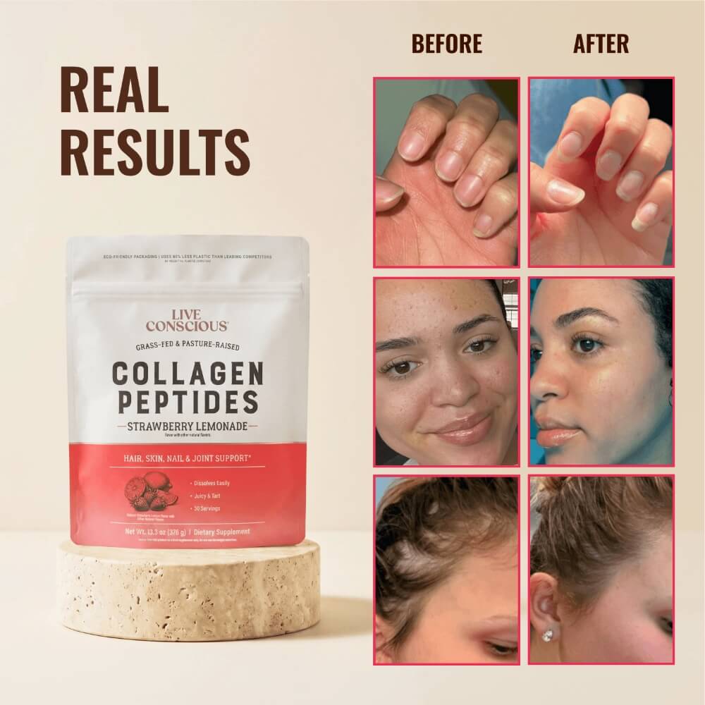 Collagen Peptides Strawberry Lemonade